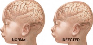 Zika-Virus-Baby-flyer