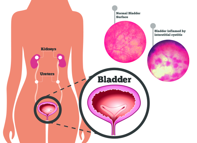 bladder diagram detailed